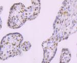 DNA ligase IV Antibody in Immunohistochemistry (Paraffin) (IHC (P))