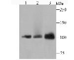 DNA ligase IV Antibody in Western Blot (WB)