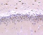 Cullin 1 Antibody in Immunohistochemistry (Paraffin) (IHC (P))