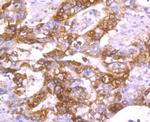 TFF1 Antibody in Immunohistochemistry (Paraffin) (IHC (P))