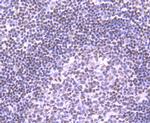 NRF1 Antibody in Immunohistochemistry (Paraffin) (IHC (P))