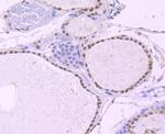 NRF1 Antibody in Immunohistochemistry (Paraffin) (IHC (P))