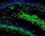 GCLM Antibody in Immunocytochemistry (ICC/IF)