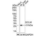 GCLM Antibody in Western Blot (WB)