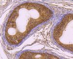 RAD51 Antibody in Immunohistochemistry (Paraffin) (IHC (P))