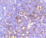 HP1 gamma Antibody in Immunohistochemistry (Paraffin) (IHC (P))