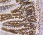 HP1 gamma Antibody in Immunohistochemistry (Paraffin) (IHC (P))