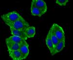 alpha Actinin 4 Antibody in Immunocytochemistry (ICC/IF)