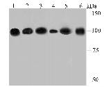 alpha Actinin 4 Antibody in Western Blot (WB)