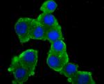 GluR2 Antibody in Immunocytochemistry (ICC/IF)