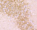 GluR2 Antibody in Immunohistochemistry (Paraffin) (IHC (P))