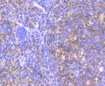 HPRT1 Antibody in Immunohistochemistry (Paraffin) (IHC (P))