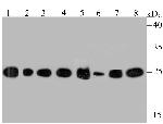 HPRT1 Antibody in Western Blot (WB)