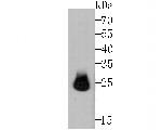 HPRT1 Antibody in Western Blot (WB)