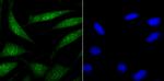 USP22 Antibody in Immunocytochemistry (ICC/IF)