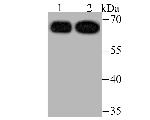 USP22 Antibody in Western Blot (WB)