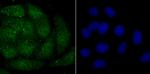 Histone Macro-H2A.1 Antibody in Immunocytochemistry (ICC/IF)