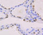 Histone Macro-H2A.1 Antibody in Immunohistochemistry (Paraffin) (IHC (P))