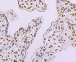 Histone Macro-H2A.1 Antibody in Immunohistochemistry (Paraffin) (IHC (P))