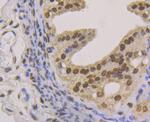 Histone Macro-H2A.1 Antibody in Immunohistochemistry (Paraffin) (IHC (P))