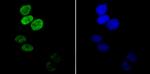 H3K14ac Antibody in Immunocytochemistry (ICC/IF)