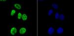 H3K14ac Antibody in Immunocytochemistry (ICC/IF)