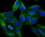 LOX Antibody in Immunocytochemistry (ICC/IF)