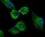 LOX Antibody in Immunocytochemistry (ICC/IF)