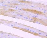 LOX Antibody in Immunohistochemistry (Paraffin) (IHC (P))