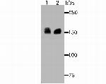 Drosha Antibody in Western Blot (WB)