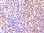 MAD2L2 Antibody in Immunohistochemistry (Paraffin) (IHC (P))