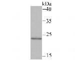 MAD2L2 Antibody in Western Blot (WB)