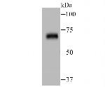 Zap-70 Antibody in Western Blot (WB)