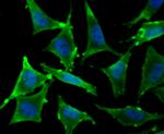 TPT1 Antibody in Immunocytochemistry (ICC/IF)