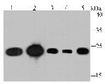 TPT1 Antibody in Western Blot (WB)