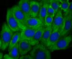 Growth Hormone Receptor Antibody in Immunocytochemistry (ICC/IF)