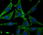 Growth Hormone Receptor Antibody in Immunocytochemistry (ICC/IF)