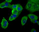 PCSK9 Antibody in Immunocytochemistry (ICC/IF)