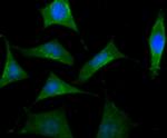 B-Raf Antibody in Immunocytochemistry (ICC/IF)