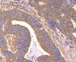 B-Raf Antibody in Immunohistochemistry (Paraffin) (IHC (P))