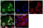 PRMT5 Antibody in Immunocytochemistry (ICC/IF)