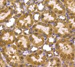 PRMT5 Antibody in Immunohistochemistry (Paraffin) (IHC (P))