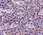 PRMT5 Antibody in Immunohistochemistry (Paraffin) (IHC (P))