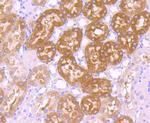 GCLC Antibody in Immunohistochemistry (Paraffin) (IHC (P))