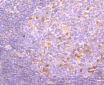 PKC beta-1 Antibody in Immunohistochemistry (Paraffin) (IHC (P))