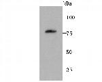 PKC beta-1 Antibody in Western Blot (WB)