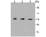 IkB epsilon Antibody in Western Blot (WB)