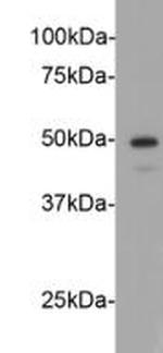 Cyclin E2 Antibody in Western Blot (WB)