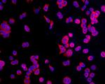 CCDC47 Antibody in Immunocytochemistry (ICC/IF)