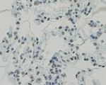 CCDC47 Antibody in Immunohistochemistry (Paraffin) (IHC (P))